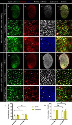 Co-transduction of dual-adeno-associated virus vectors in the neonatal and adult mouse utricles